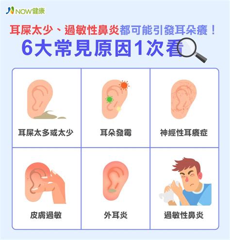 耳朵癢|耳朵癢卻沒有耳屎，是耳朵發黴？專家曝6大原因、4緩解法 